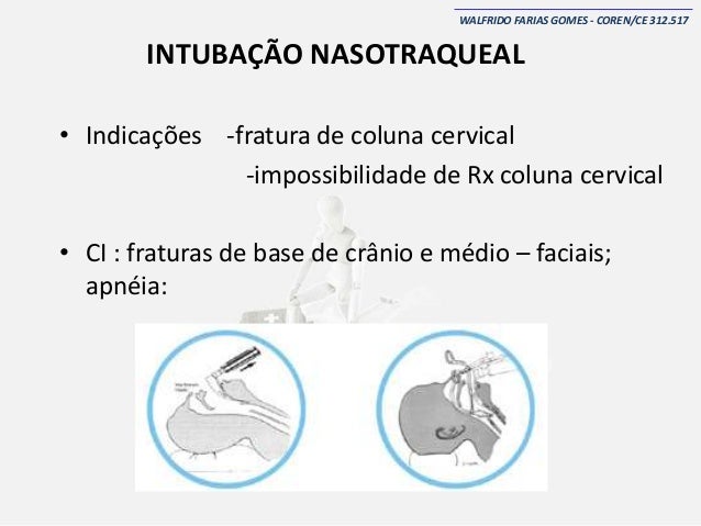 Secuencia Rapida De Intubacion Epub Download
